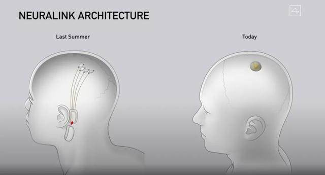 陈根：脑机接口活体试验成功，可读取大脑信息将进入人体实验插图(1)