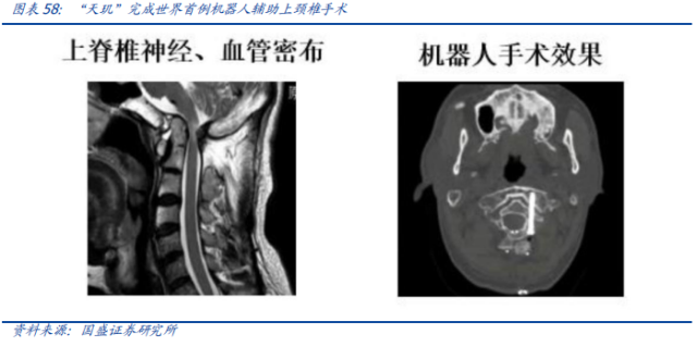 骨科机器人：天智航的蓝天究竟有多宽？插图(8)