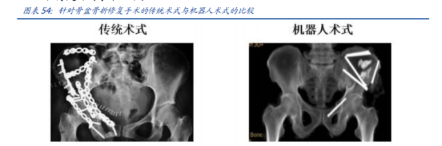 骨科机器人：天智航的蓝天究竟有多宽？插图(6)